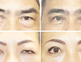 Learn To Age Gracefully With Right Touch